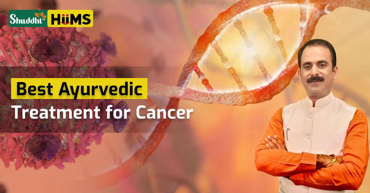 Best Ayurvedic Treatment for Cancer