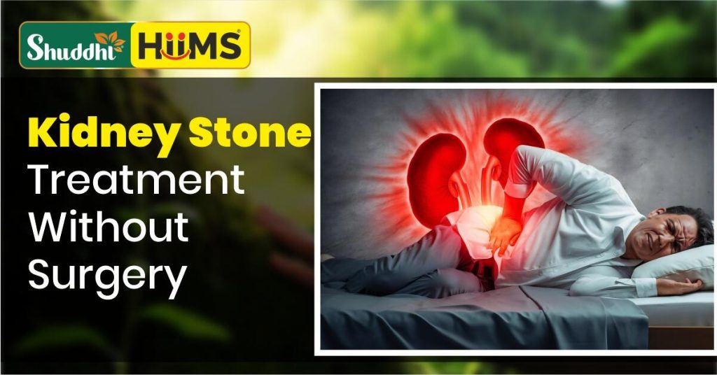 Kidney Stone Treatment Without Surgery