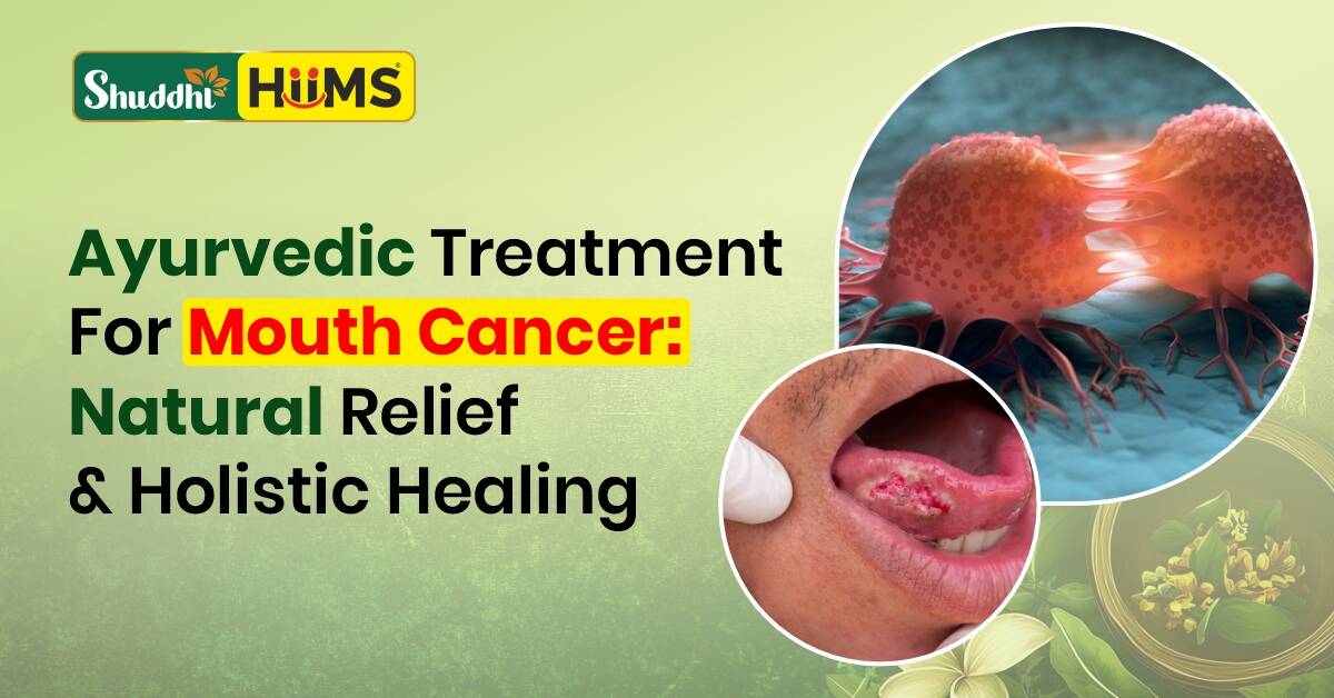 Ayurvedic Treatment for Mouth Cancer