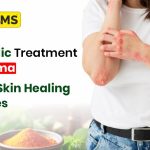 Ayurvedic Treatment for Eczema