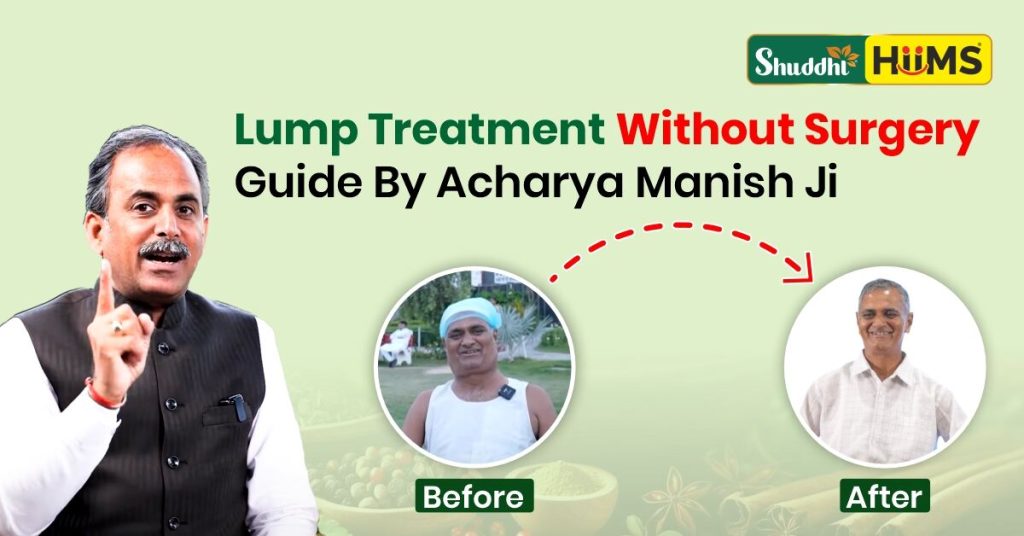 Lipoma Treatment Without Surgery