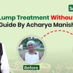 Lipoma Treatment Without Surgery